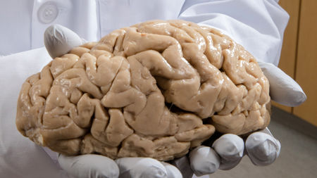 Human%20Brain